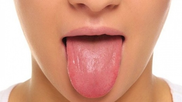 Глоссит – инфекция языка